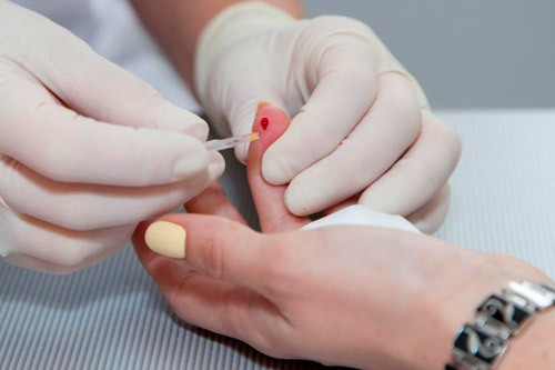 Сильное сердцебиение: причины, что делать