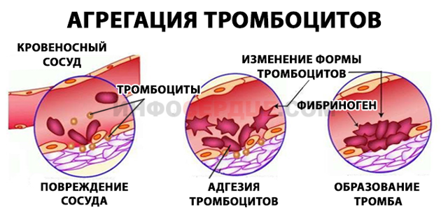 Агрегация тромбоцитов с АДФ, адреналином, ристомицином, коллагеном – норма. Что такое агрегация, гиперагрегация, гипоагрегация тромбоцитов?
