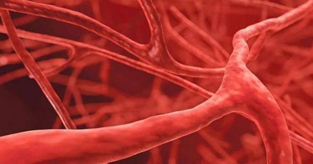 Васкулит мозга