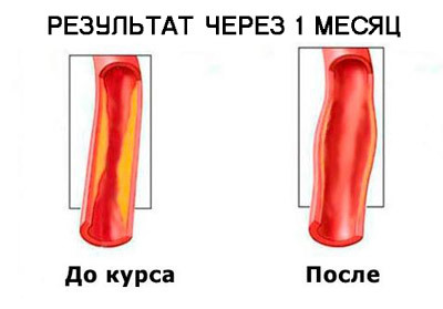 Гипертофорт: инструкция по применению, цена, отзывы, состав