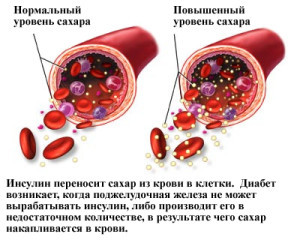 Уровень инсулина в крови: норма и причины отклонения гормона