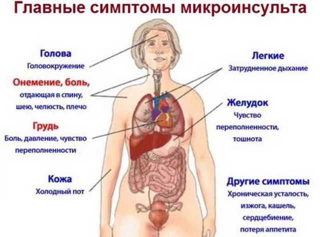 Микроинсульт – симптомы и последствия, признаки, лечение, или Берегите здоровье смолоду