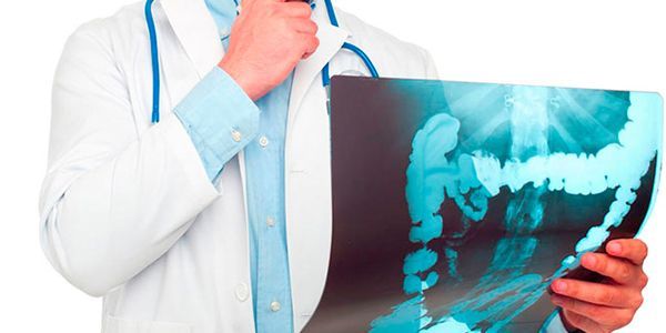 Трещина прямой кишки: симптомы, диагностика, лечение