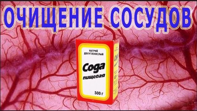 Очищение сосудов. Как очищать сосуды разумно, безопасно, в домашних условиях?