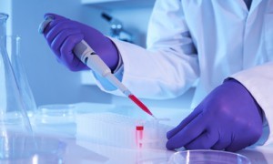 Что означает скорость оседания эритроцитов повышена и причины этого