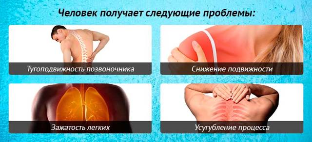 Остеохондроз грудной клетки