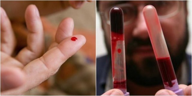 Что делать, если густая кровь при беременности? - Здоровая кровь