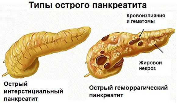 Как снизить пульс в домашних условиях быстро