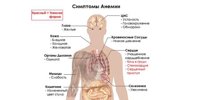 Болезнь крови. Болезни органов крови
