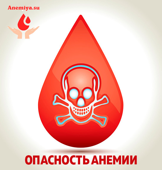 Анемия - что это такое и чем опасна, симптомы и лечение анемии, что кушать и как лечить
