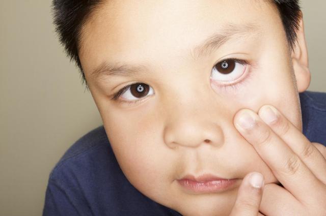 Глазные капли Диклофенак: инструкция по применению Дикло Ф, аналоги, показания, отзывы