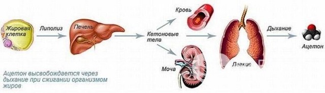 Кетоацидоз у детей и взрослых