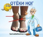 Пролапс митрального клапана – что это, чем опасен?