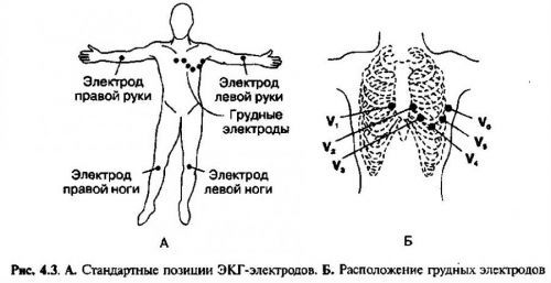 Техника снятия электрокардиограммы