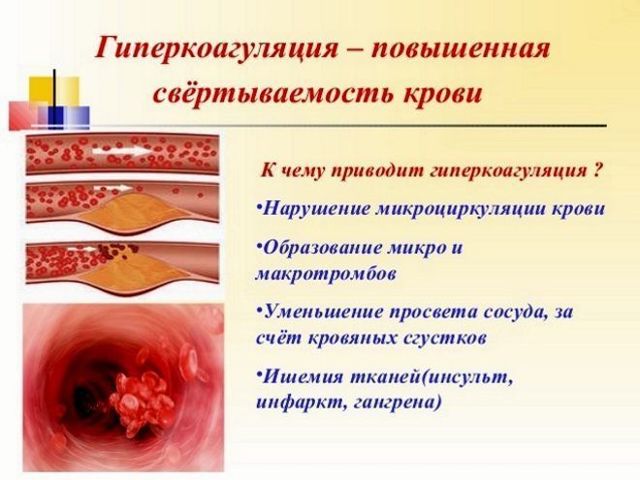К чему приводит закупорка сосудов в ноге. Признаки и методы лечения закупорки сосудов на ногах