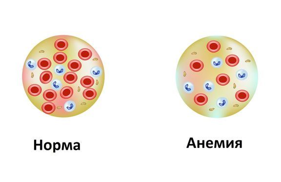 Гемоглобин: за что отвечает в организме и что означает пониженный и повышенный показатель гемоглобина в крови человека?