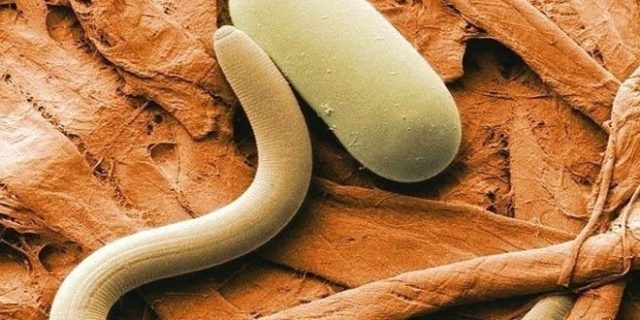 Моноциты - что это такое и какую функцию в крови они выполняют, показатели нормы моноцитов и методы лечения при их отклонениях