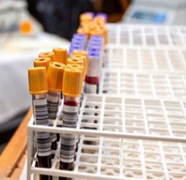 Щелочная фосфатаза в крови понижена у женщин - причины