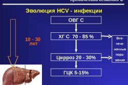 Качественный анализ на гепатит С: определение РНК вируса 2019