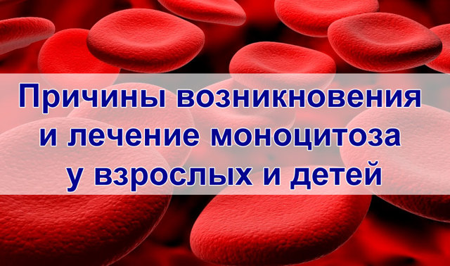 Моноцитоз у взрослых и детей: причины, виды, симптомы