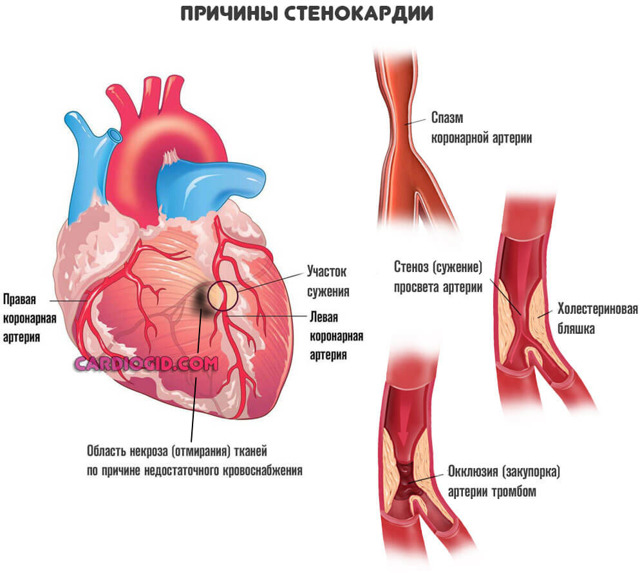 Антикоагулянты – механизм действия, список препаратов