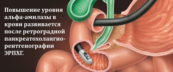 Альфа-амилаза в крови повышена