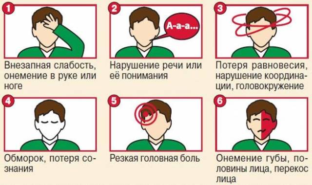 Предпосылки инсульта головного мозга у женщин - как избежать инсульта у женщин