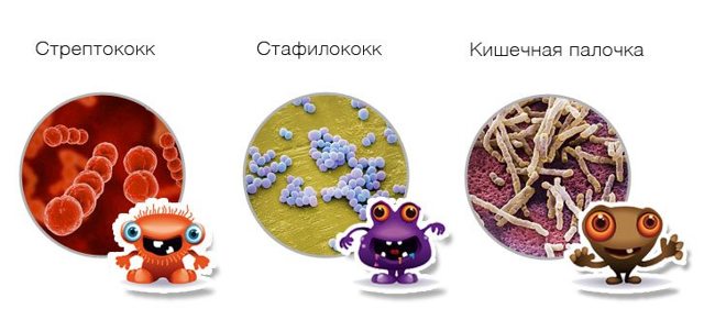 Лекарства последнего поколения для лечения ревматоидного артрита
