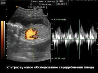 Когда начинает биться сердце у эмбриона
