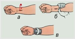 Виды кровотечений и оказание первой помощи