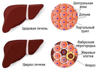 Щелочная фосфатаза в анализе крови (ЩФ): норма у женщин и мужчин, причины повышенных и пониженных значений