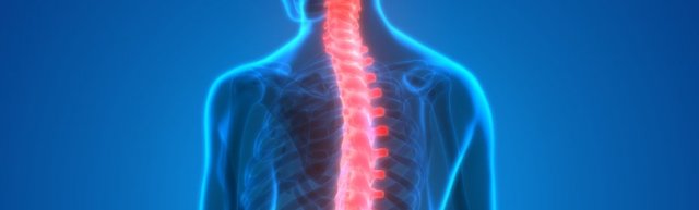 Инсульт спинного мозга (спинальный): симптомы, лечение, последствия