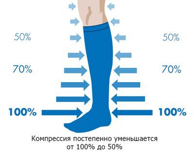 Компрессионные наколенники при варикозе на сайте варикоз