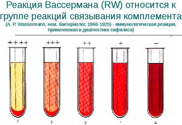 Реакция Вассермана – что это