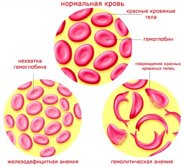 Онкомаркеры - что это такое, расшифровка и норма