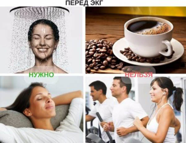 Картинки ЭКГ при нарушениях ритма
