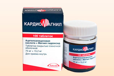 Крупноочаговый инфаркт миокарда