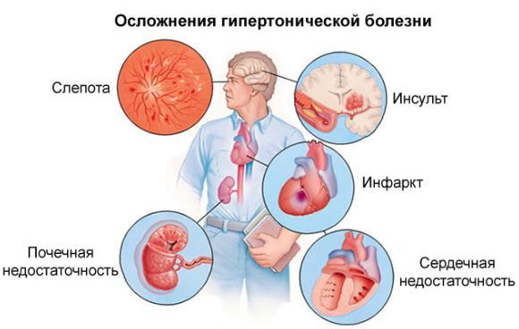 Верхнее давление высокое нижнее в норме