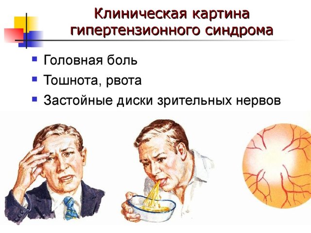 Гипертензионный синдром у детей и взрослых: симптомы, лечение