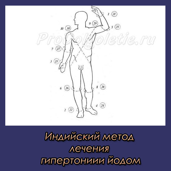 Лечение гипертонии йодом (по индийскому методу)