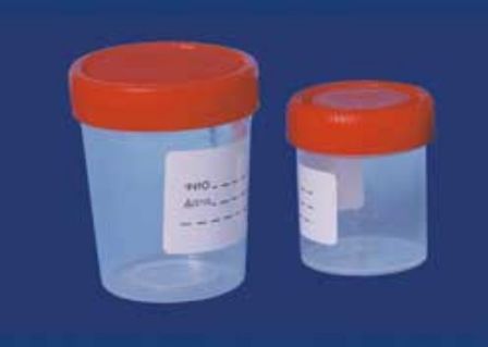 Посев крови - что это, что показывает бактериологический посев