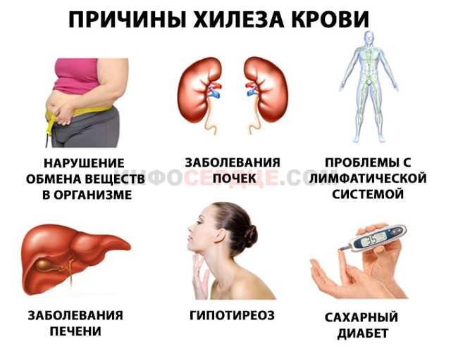 Хилез крови у взрослых и детей: что это, причины и лечение