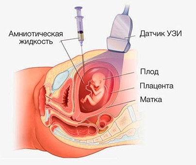 Как запланировать и зачать мальчика по овуляции, календарям и таблицам планирования пола, по обновлению крови