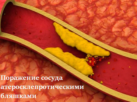 Нормы липидов в крови, гормональная функция липидов