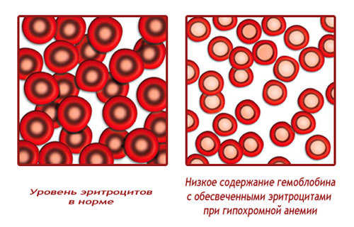 Mch в анализе крови что это такое норма