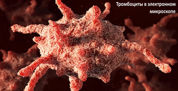 Тромбокрит (PCT) выше нормы — что это значит?