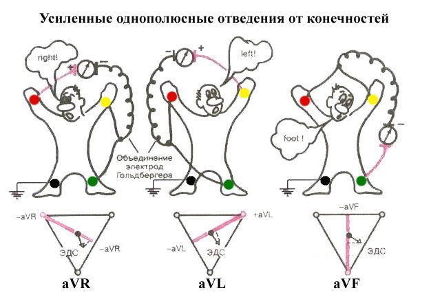 Экг отведения по слопаку - Лечение гипертонии