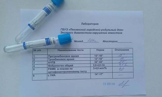 Гемостазиограмма - «золотой стандарт» анализов при беременности
