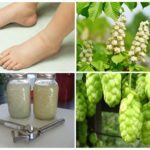 Отеки при варикозе - снимаем быстро и надолго