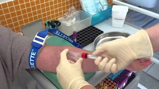 На что влияет повышенный билирубин в крови. Повышенный билирубин в крови: причины, симптомы и способы понижения